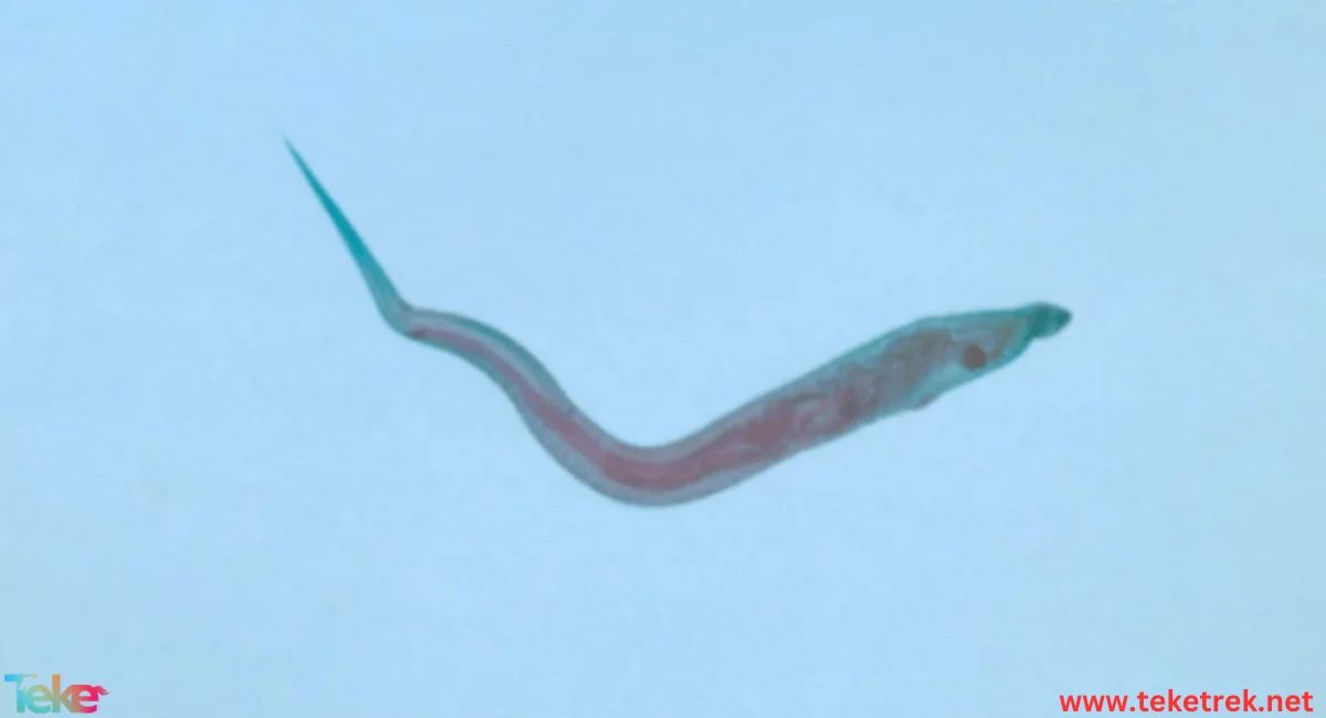 Pinworm